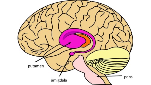  Slika 2: Prikaz področij možganov, kjer se izraža povečana aktivnost nevronov pri pojavu potovalne slabosti.(Avtorsko delo.)